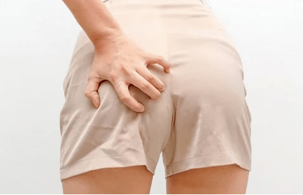 Anal itch
