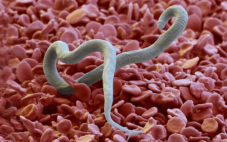 Dirofilaria - a parasite that enters the skin through insect bites