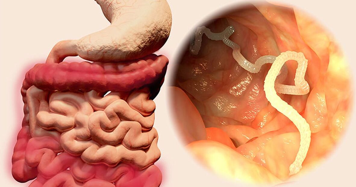 parasites in the human intestine