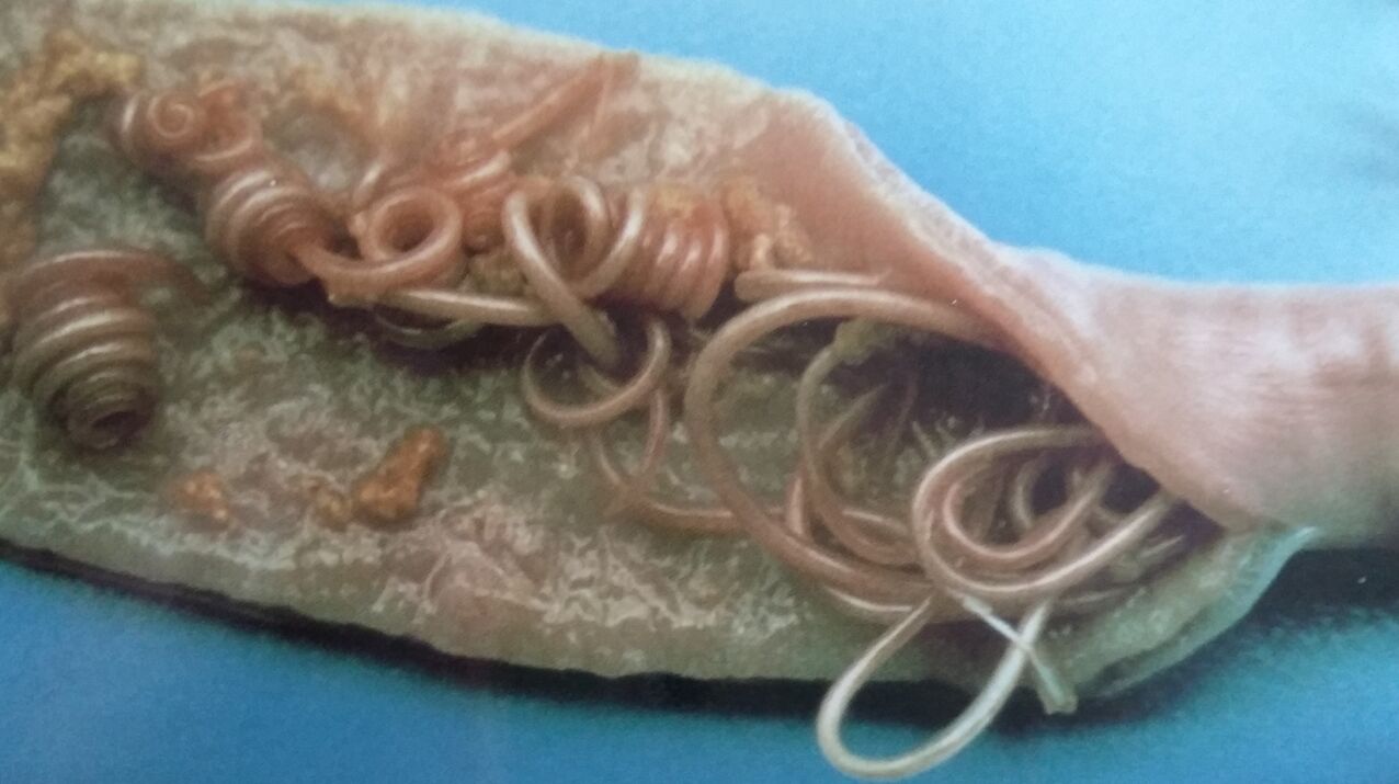 roundworm of the human body