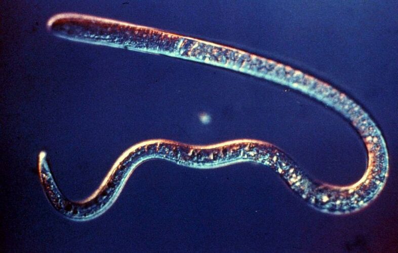 parasitic worm of the human body