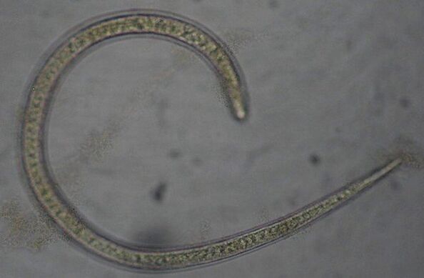 Trichinella is a protostomous round parasitic worm